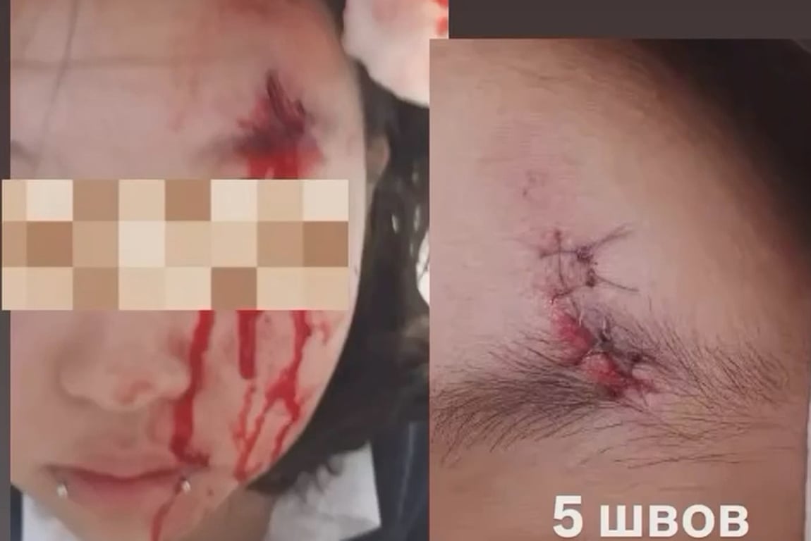 Последствия избиения девочки в ЖК «Саларьево Парк». Фото: «Весь Улан-Удэ» / <a href="https://t.me/ves_uu/20750" target="_blank">Telegram</a>‘ class=”image-widget-img aspect-[3/2] w-full rounded-lg object-cover object-top” loading=”eager” fetchpriority=”high” itemprop=”url” decoding=”sync”></picture>
<meta itemprop="caption" content=
