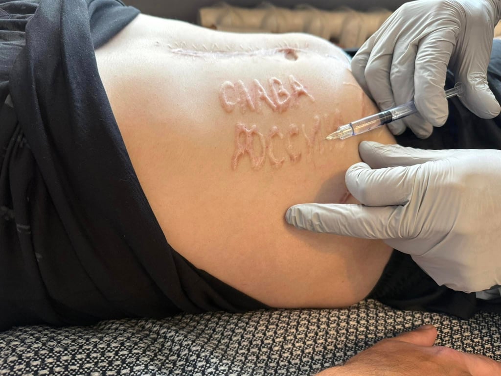 Надпись, выжженая на животе Андрея Переверзева. Фото: Александр Туркевич / Facebook