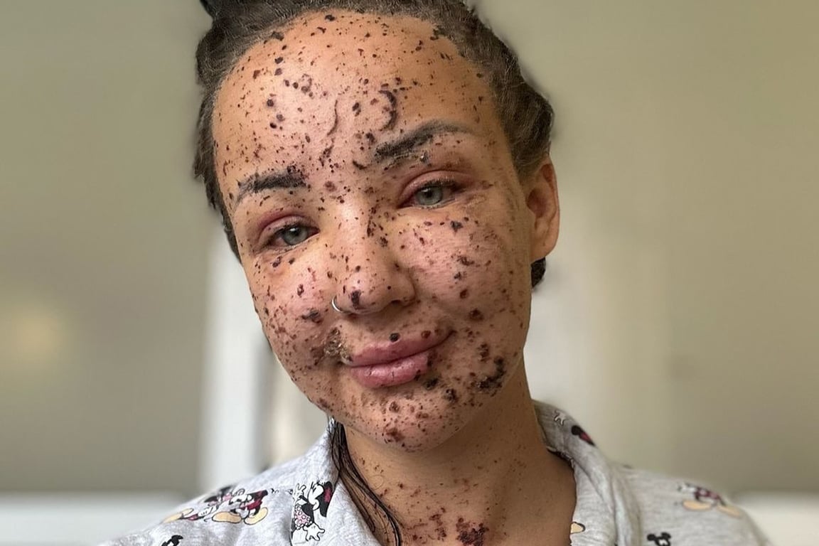 Яна Залевская. Фото: «Неопалимі» /  Facebook