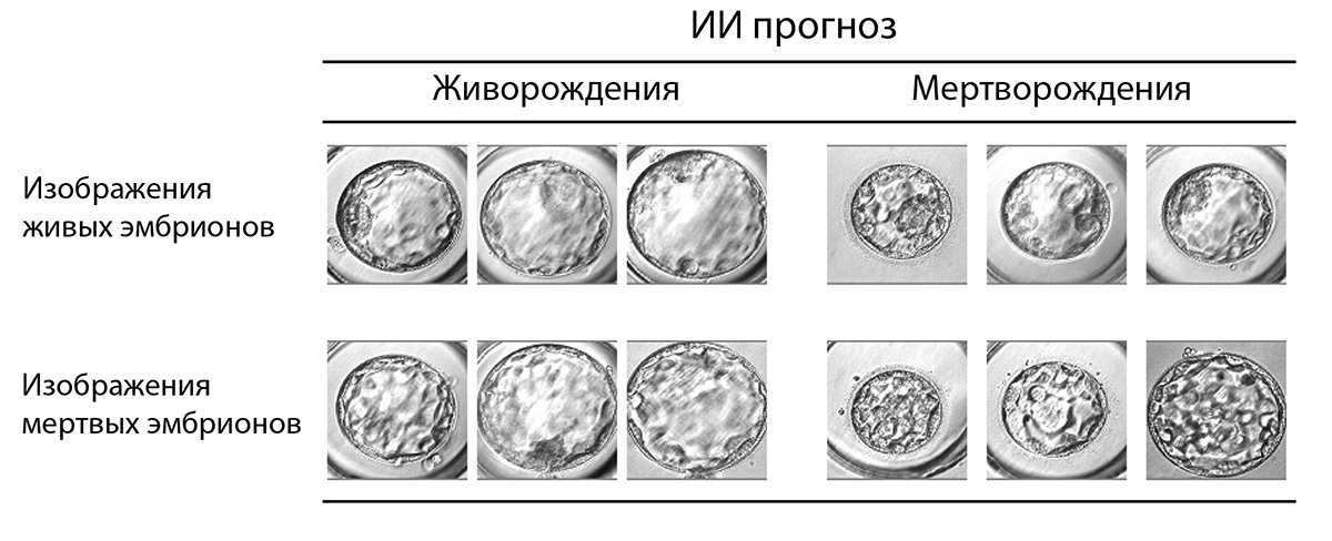 ИИ-система предсказывает перспективы развития эмбрионов / onlinelibrary.wiley.com. Сверху: ИИ-прогноз живорождения и мертворождения, снизу: изображения живых и мертвых эмбрионов