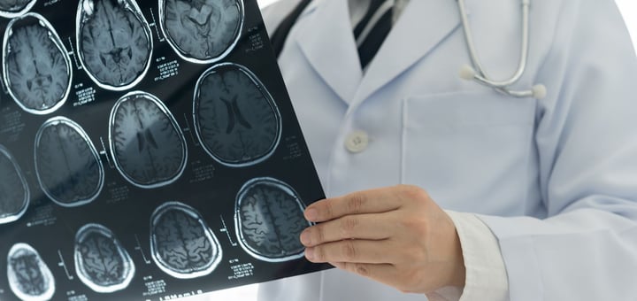 המרכז לטרשת נפוצה והיחידה לנוירואימונולוגיה וטיפולים תאיים הדסה עין כרם