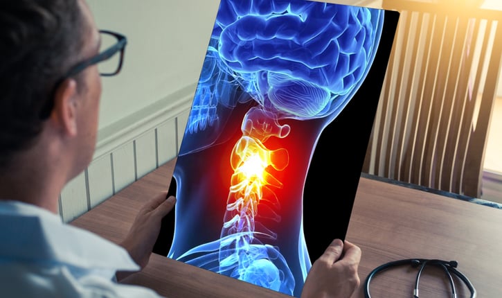 סרטן ראש וצוואר