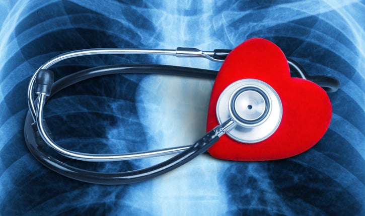 גידולים בחלל הפלאורלי 