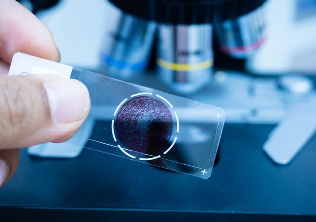 האגף ההמטולוגי