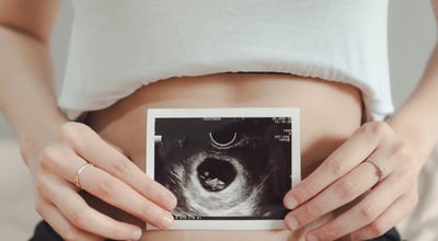 שבוע שלישי להריון 