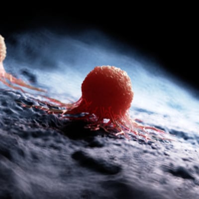 גידולים שפירים של רקמה רכה	