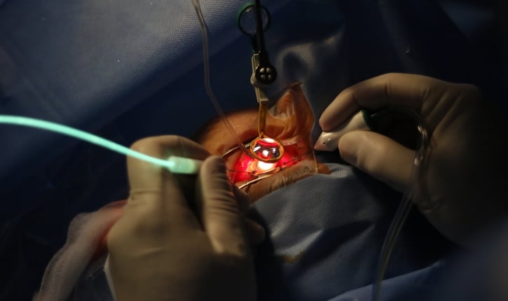 ויטרקטומיה