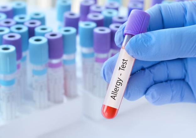 מרפאת אלרגיה