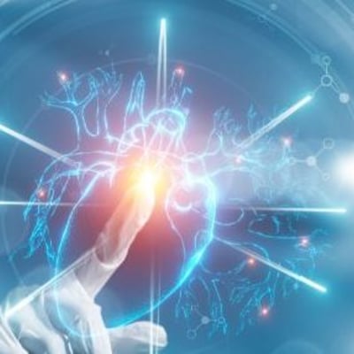 הדרכה לפני MRI לב