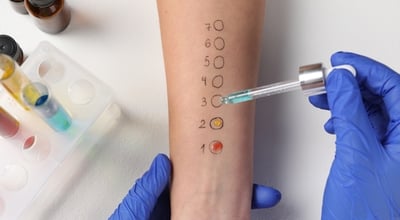 תרופות ביולוגיות לטיפול באלרגיה