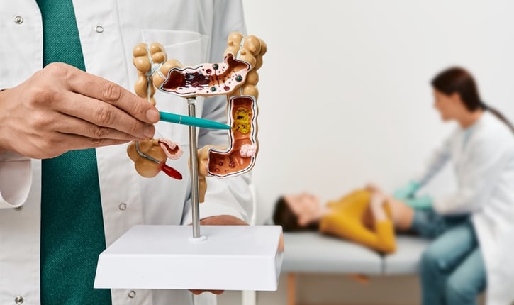 גידולי המעי הגס והרקטום