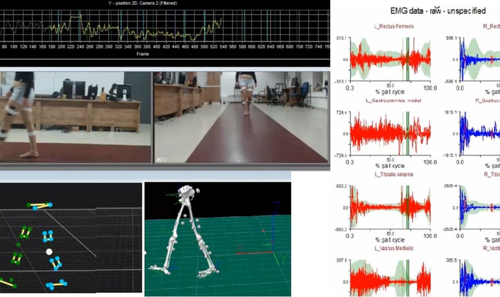 מדידת תנועתיות מותאמת אישית של כל מפרק המשתתף בתנועה