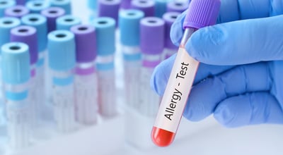 היחידה לאלרגיה ואימונולוגיה