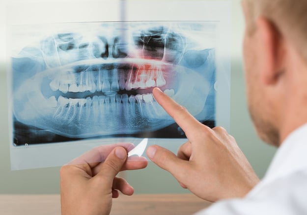 המרפאה לטיפול אורתודונטי בשיניים כלואות