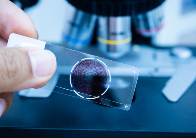 מרפאות המטולוגיה ומרפאות קרישה