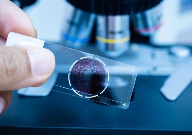 האגף ההמטולוגי