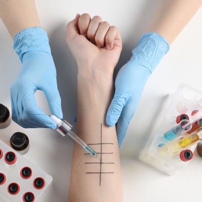 התמחות ביחידה לאימונולוגיה קלינית ואלרגיה – הדסה עין כרם