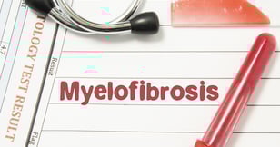 מילופיברוזיס