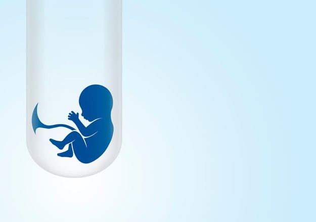 הפריה חוץ גופית