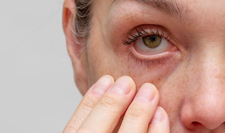 אובאיטיס - מחלות הענביה