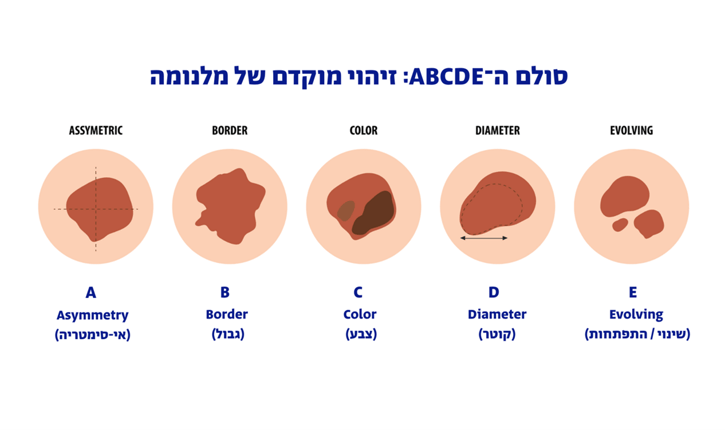 זיהוי מלנומה