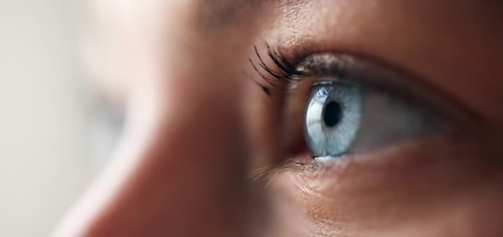 Limbal Dermoid excision