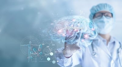 דמנציה ואלצהיימר