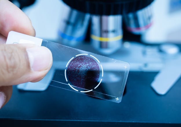 יחידת האפרזיס