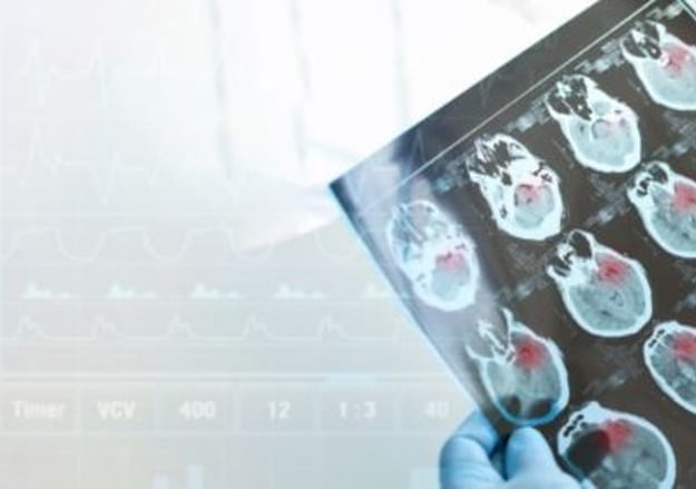 חבלות ראש וטיפול נמרץ נוירוכירורגי