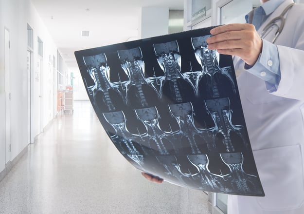 השרות לנוירוכירורגיה של עמוד שידרה הדסה עין כרם