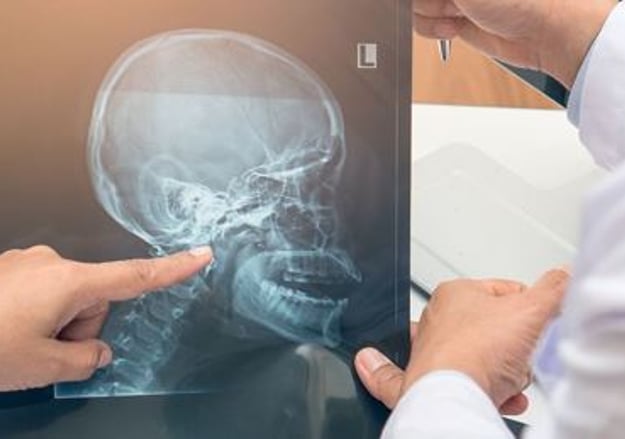 המחלקה לשיקום פנים ולסתות הדסה עין כרם