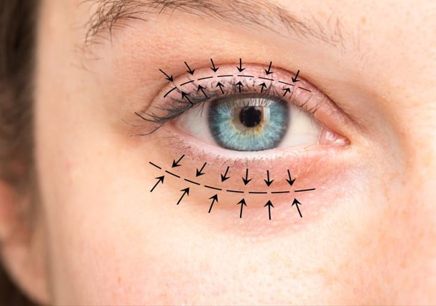 מרפאת אוקולופלסטיקה