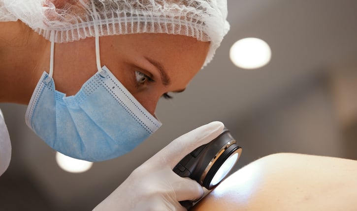 מלנומה - סרטן העור