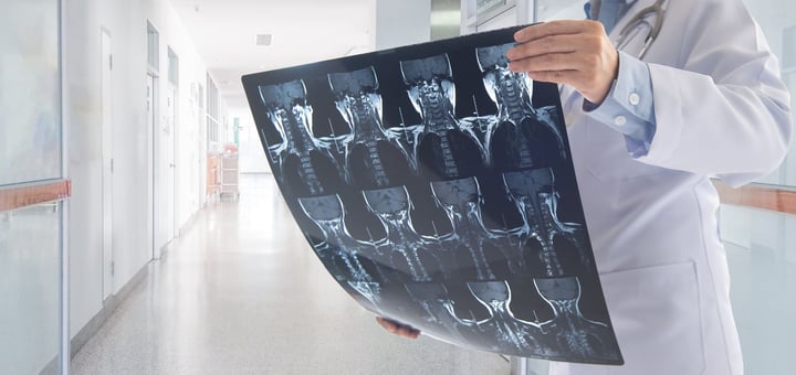 היחידה לניתוחי בסיס הגולגולת ובלוטת יותרת המוח הדסה עין כרם