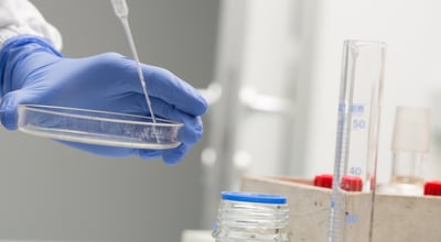 מהי בדיקת GBS