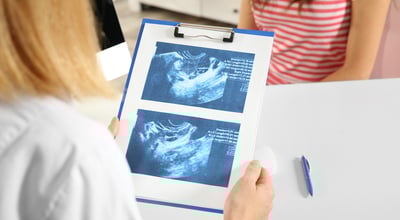 שבוע 15 להריון