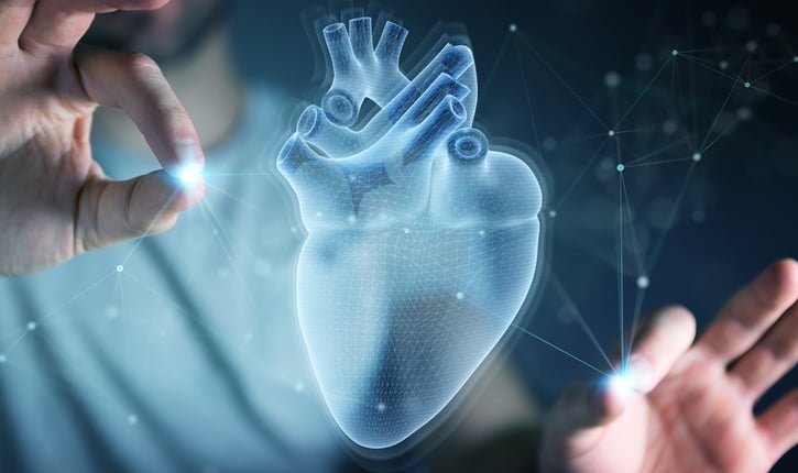 אבי העורקים