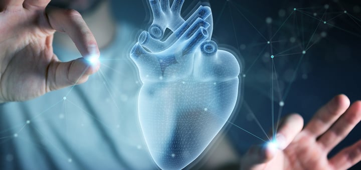 אבי העורקים