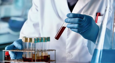 המעבדה לביוכימיה קלינית הדסה עין כרם