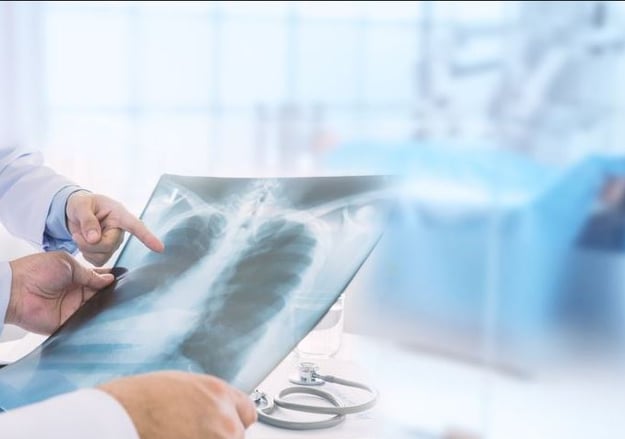 יחידת אונקולוגיה של הריאות