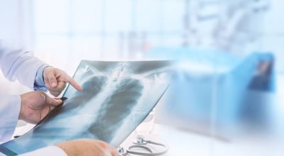 יחידת אונקולוגיה של הריאות