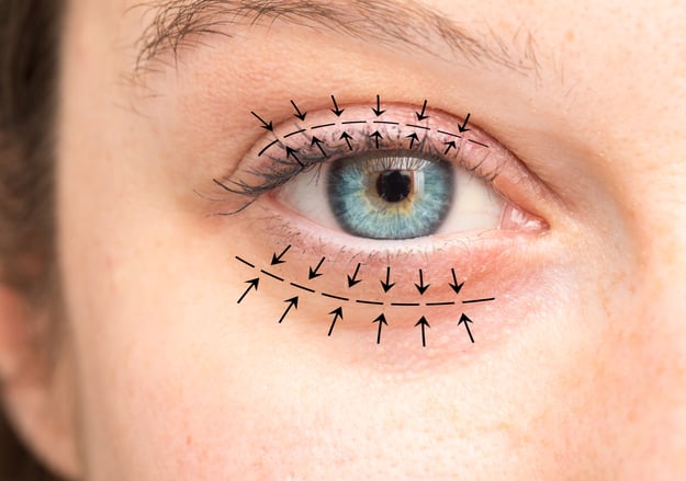 מרפאת אוקולופלסטיקה