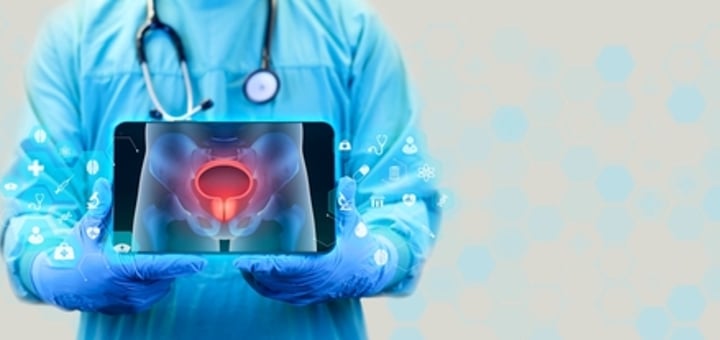 סרטן שלפוחית השתן