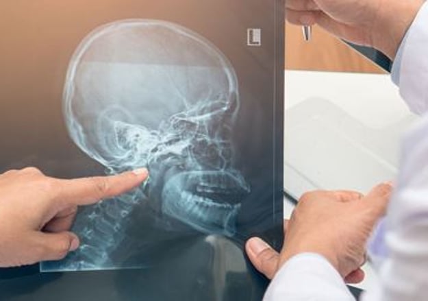 המרכז ללימודי התמחות בשיקום הפה הדסה עין כרם