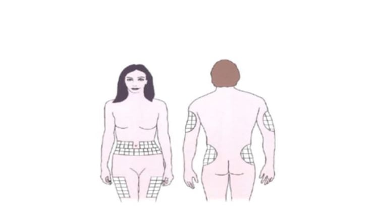 مناطق الجسم الملائمة لحقن الأنسولين (صورة 2)