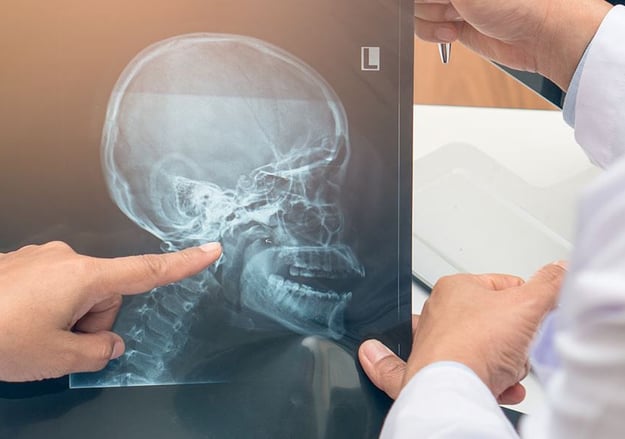 מרפאה לכאבי ראש ופנים כרוניים הדסה עין כרם