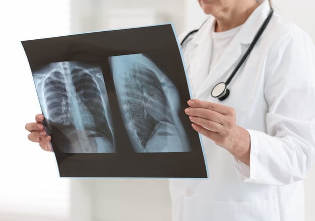 מכון הריאה הדסה עין כרם