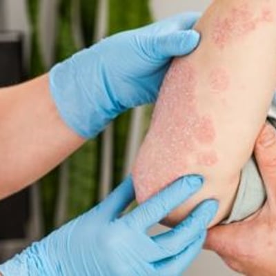 התמחות במחלות עור ומין עין כרם 