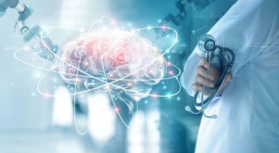 המרכז לטיפול ומניעת שבץ מוחי