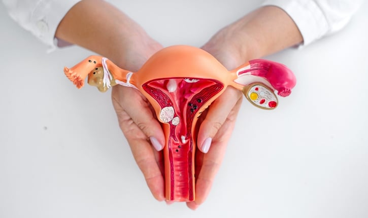 סרטן צוואר הרחם